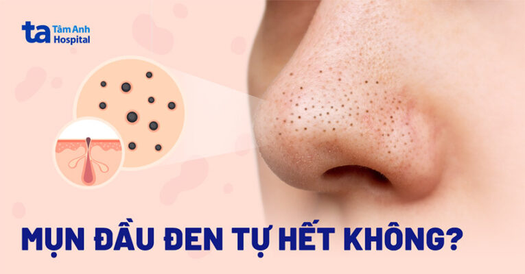 mun dau den co tu het duoc khong